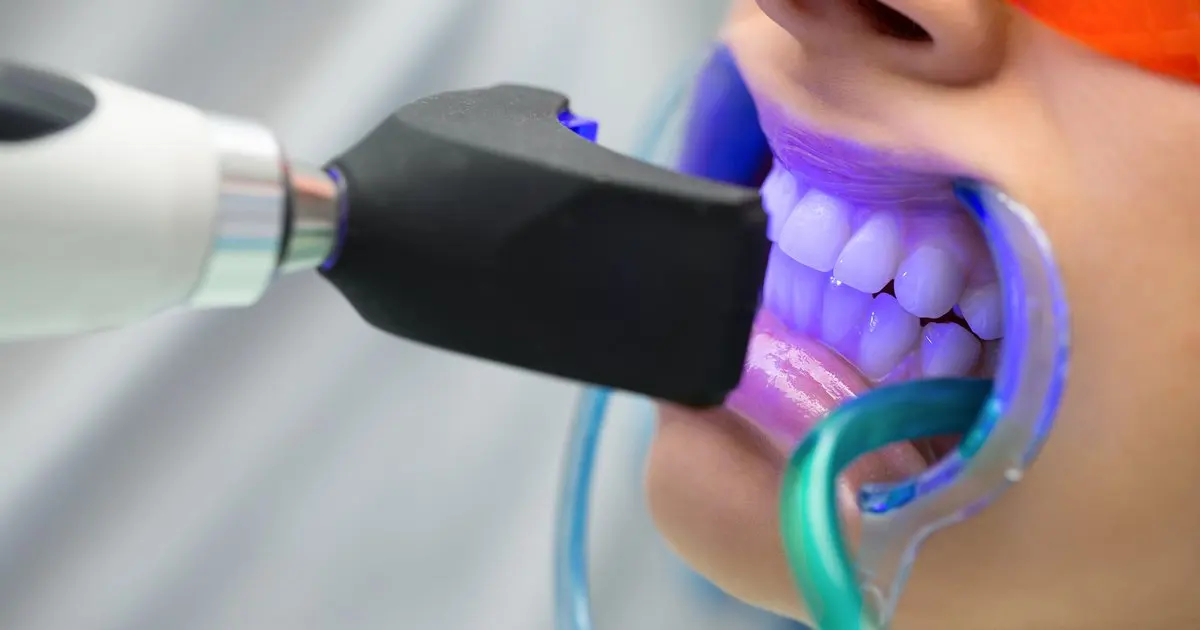 Odontología general en Opañel
